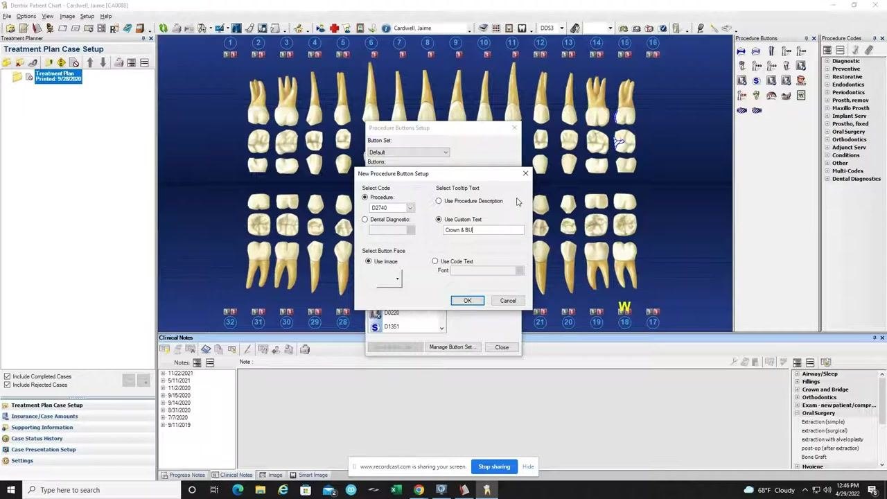 New Procedure Button Setup window with 'Use Custom Text' selected and 'Crown & BU' entered as the tooltip