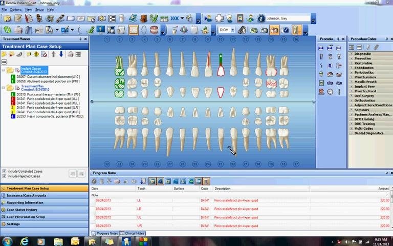 Dentrix patient chart screen showing the tooth chart, treatment plan options, and procedure codes