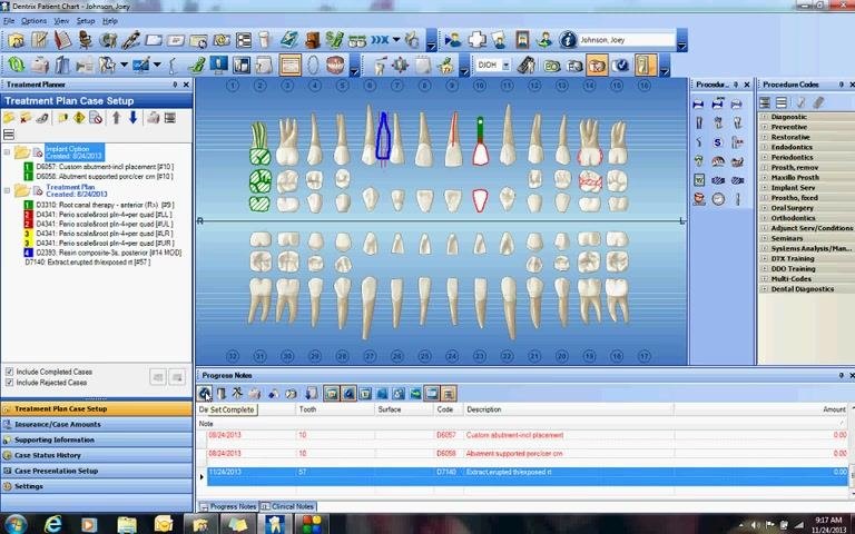 Dentrix patient chart with the extraction procedure highlighted and the Set Complete option visible