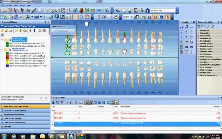 Tooth chart with the supernumerary tooth drawing erased, showing a clean, updated chart