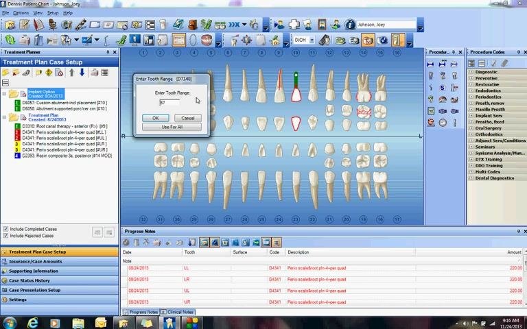 Enter Tooth Range dialog box with the value 57 entered, ready to confirm