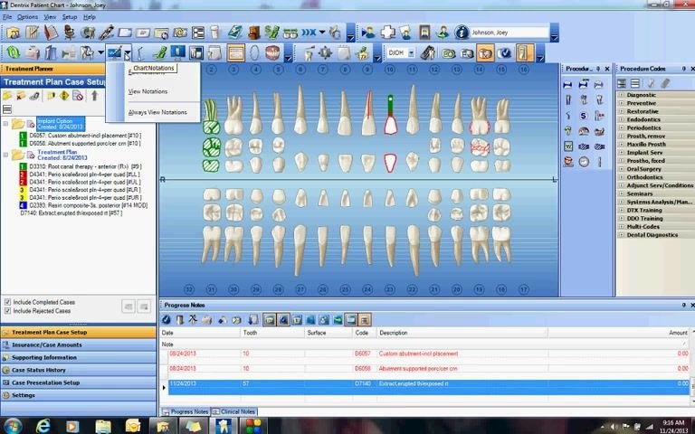 Chart Notations menu open with drawing options visible
