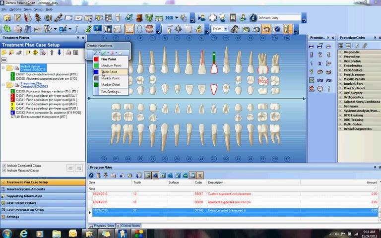 Drawing tool drop-down menu open, with the thick blue point option selected