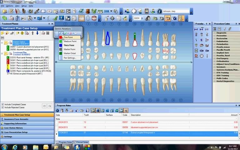 Drawing tool drop-down menu with the fine red point selected, red lines drawn through the blue-outlined supernumerary tooth