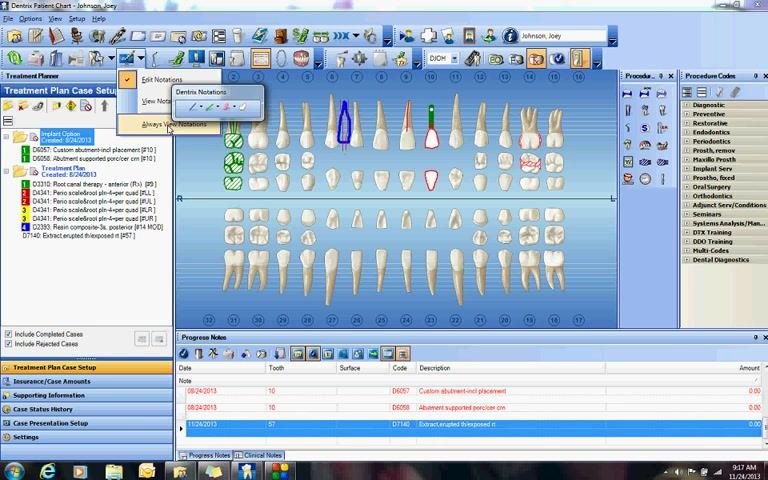 Chart Notations menu with Always View Notations selected, keeping the drawing visible on the chart