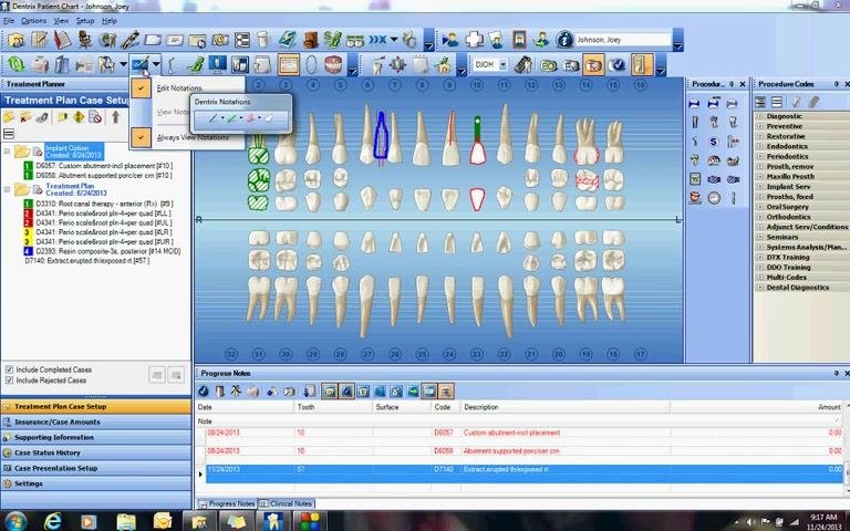 Tooth chart with notations visible and the drawing toolbar minimized