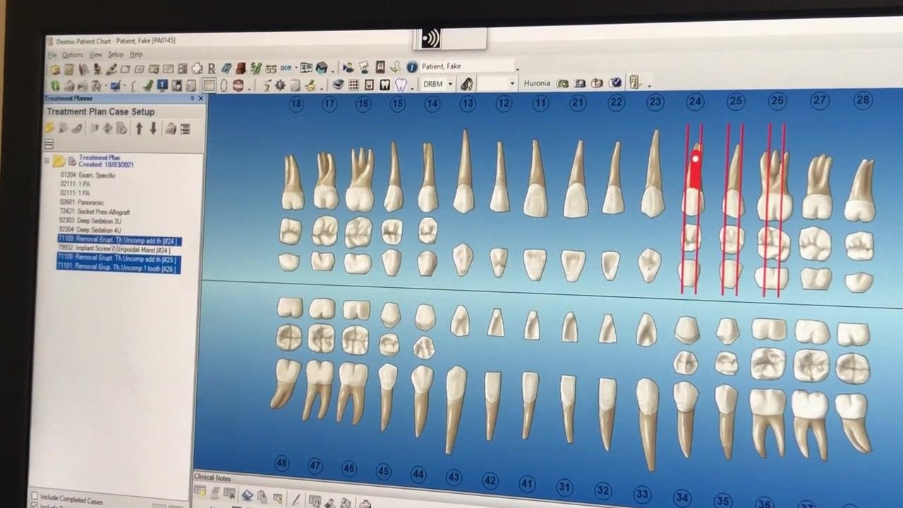 Treatment Plan Case Setup panel with multiple procedures highlighted, odontogram showing teeth 24, 25, and 26 marked in red
