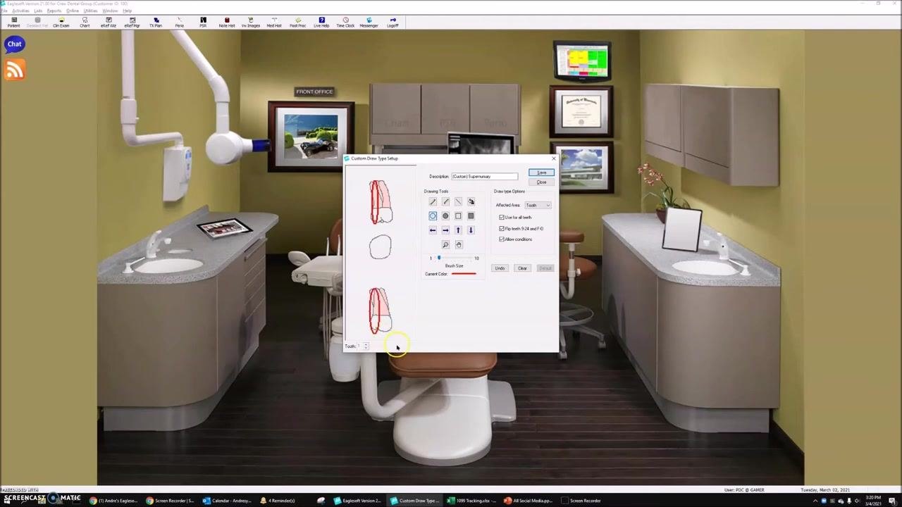 Custom Draw Type Setup window showing two outlined arches, indicating the completed custom draw type.