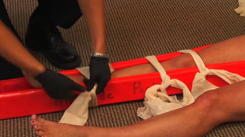 A responder ties a cravat below the fracture site, using a square knot to secure the splint. The orange rigid splint and multiple cravats are visible.