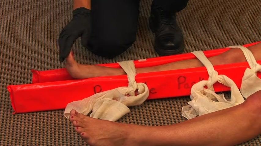 A responder checks the patient's foot for pulse and sensation after splinting. The leg is immobilized with an orange rigid splint and multiple cravats.