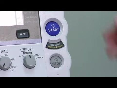 Close-up of an electronic blood pressure monitor showing the START and STOP buttons along with other labeled controls and indicators.