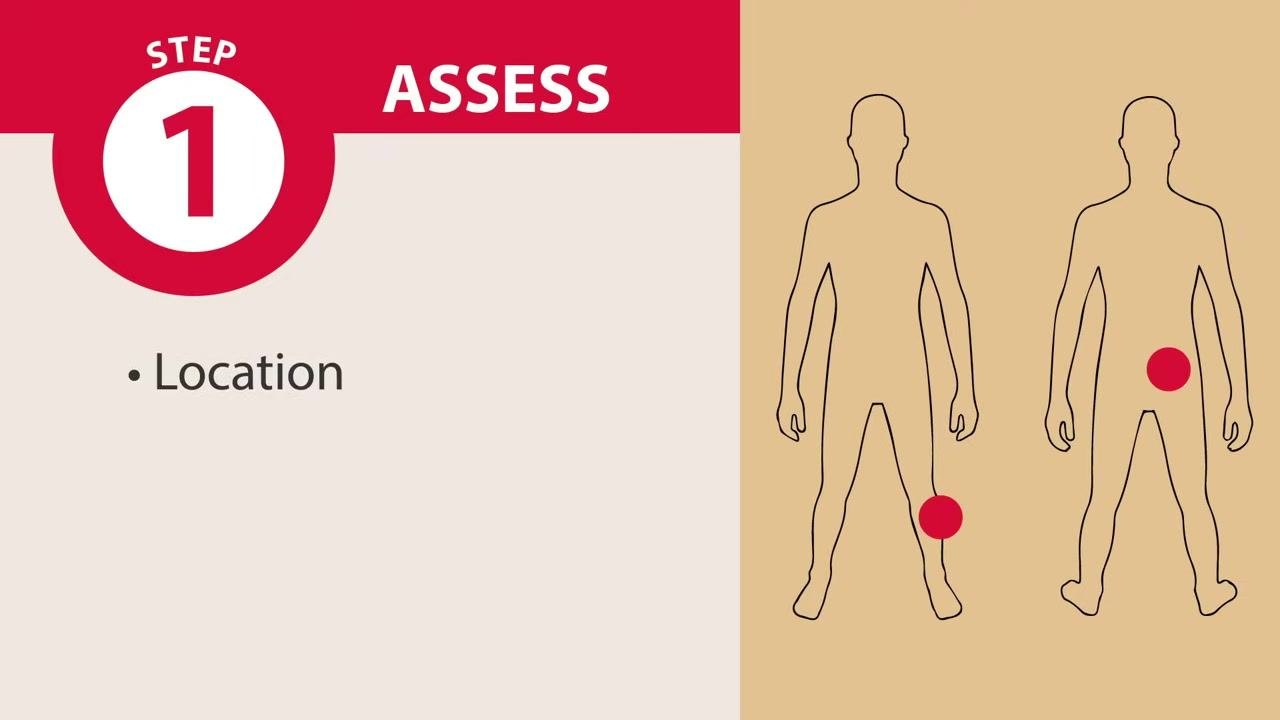 Diagram showing wound locations on two human figures, with red dots indicating specific wound sites and the label "Step 1: Assess – Location"