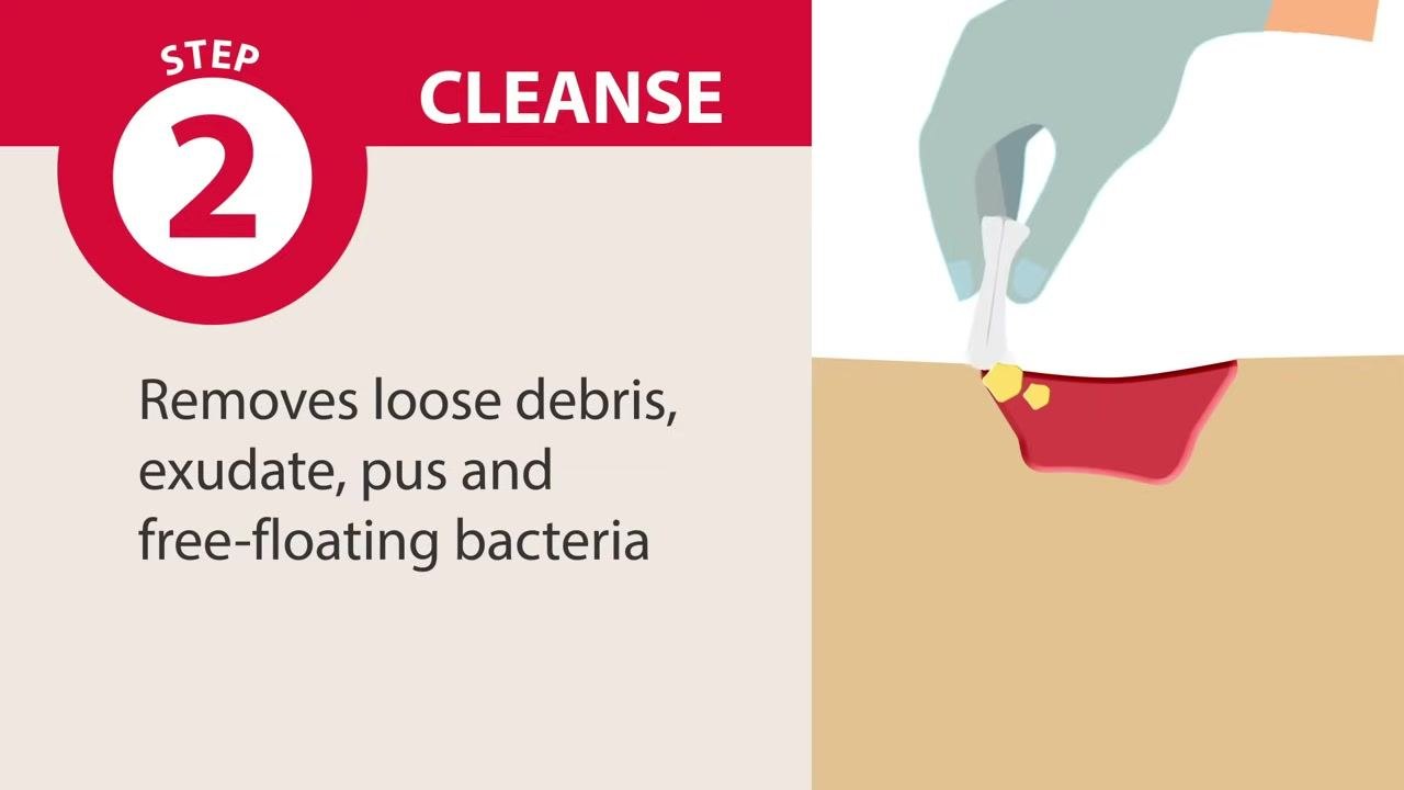 Screen showing "Step 1: Assess" with bullet points for warm wound, odor, patient fever, and level of pain, alongside an illustration of a wound with pain indicators