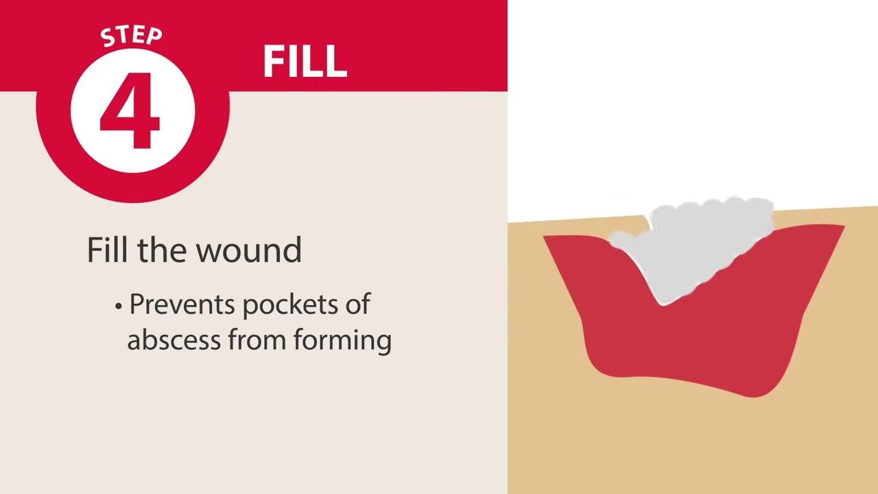 Screen labeled "Step 4: Fill" reading "Fill the wound. Prevents pockets of abscess from forming," with an illustration of a wound being filled
