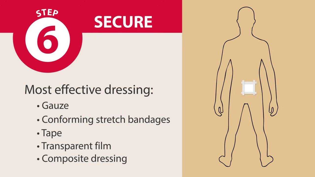 Screen labeled "Step 6: Secure" reading "Apply a secondary dressing. Promote healing. Protect the wound. Secure medical devices," with an illustration of a secondary dressing secured with tape