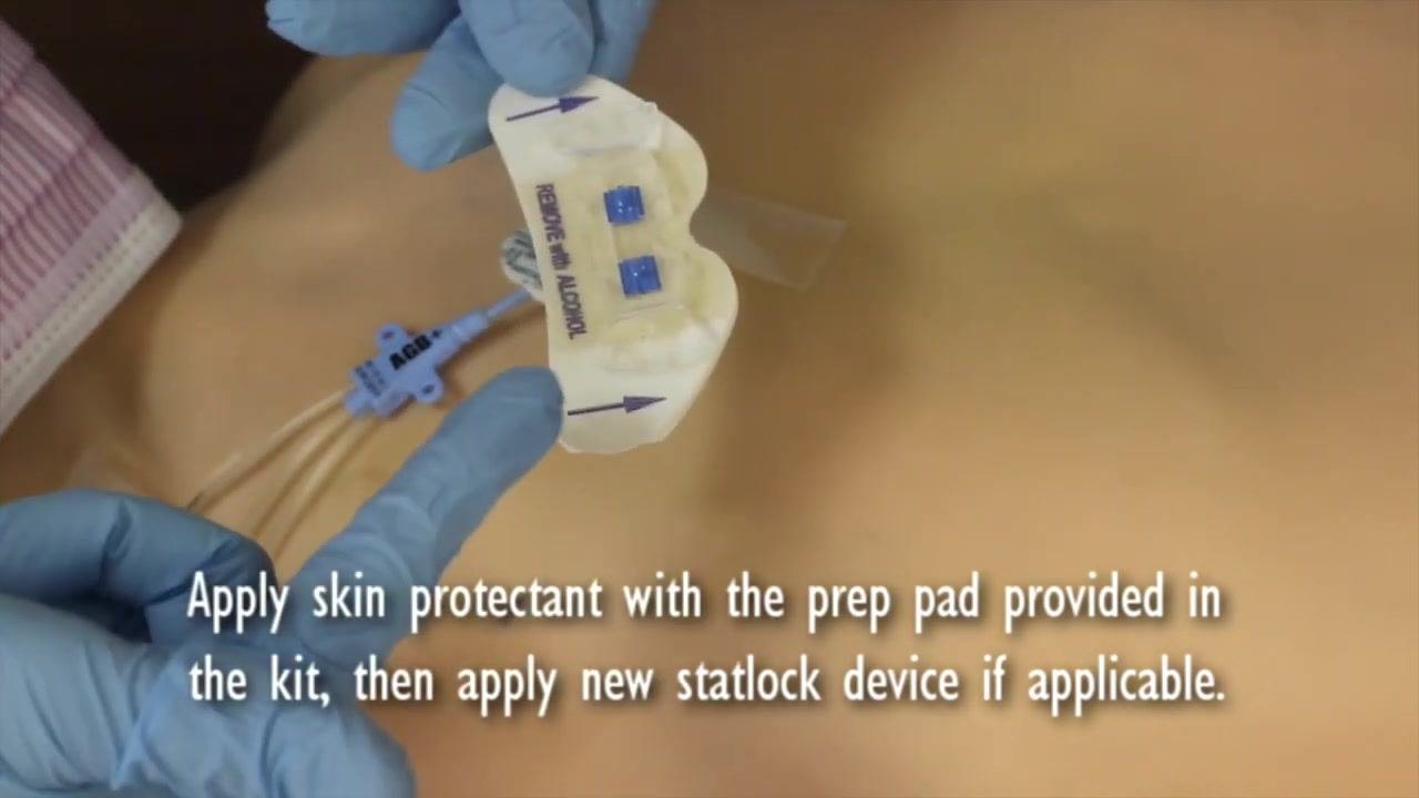 Gloved hands positioning a new StatLock device, labeled "REMOVE WITH ALCOHOL," above the central line site with catheter tubing visible.