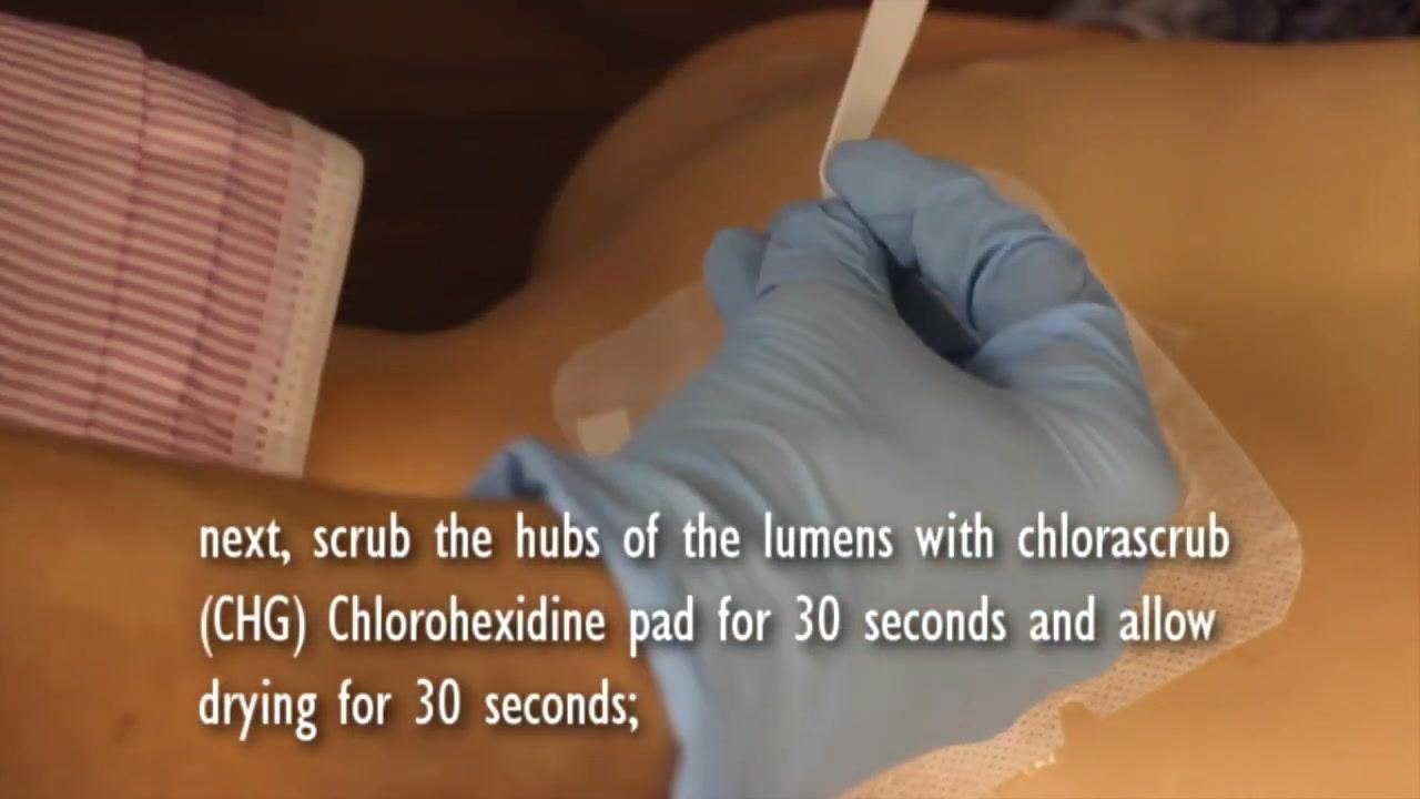 Gloved hands securing the StatLock device to the skin and fixing the catheter tubing in place.