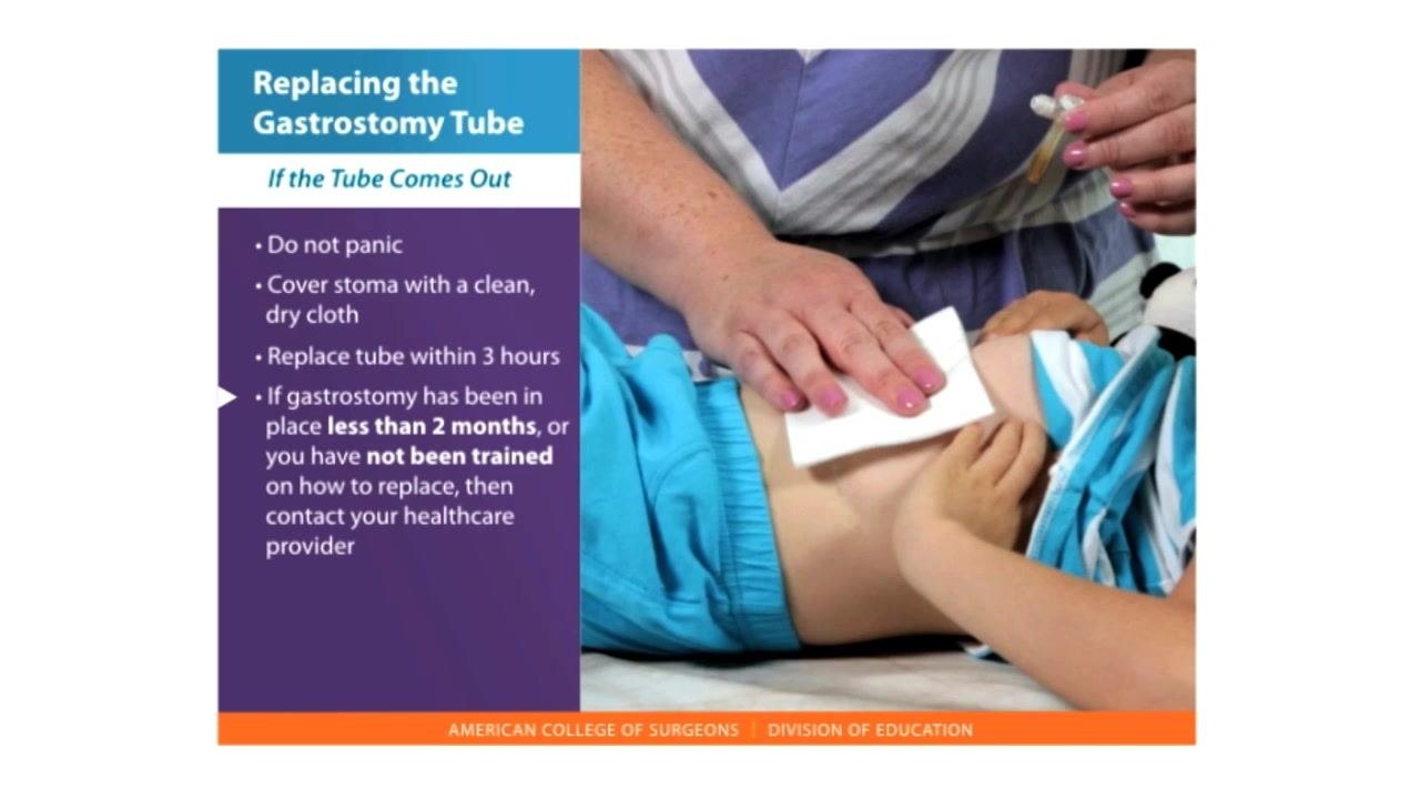 A hand holds a 5 mL slip-tip syringe next to a list reading "1. The tube that has fallen out" and "2. A 5 or 10 mL slip-tip syringe."