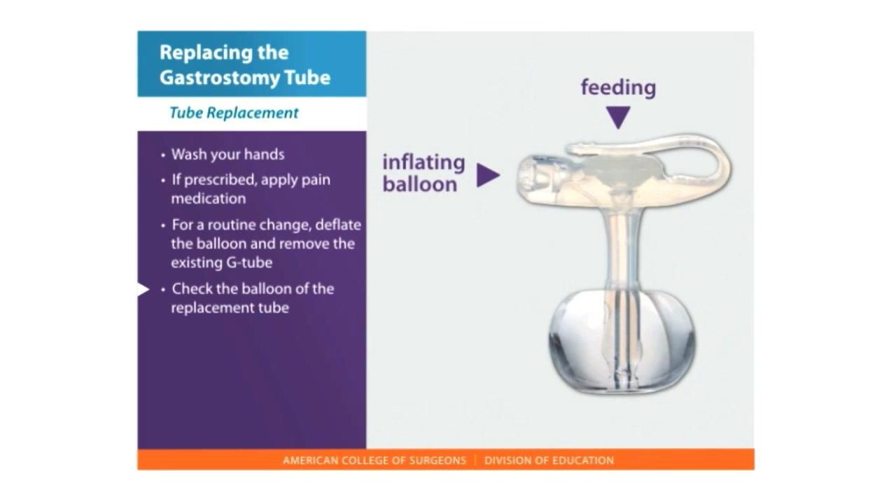 A diagram of a gastrostomy tube shows two portals labeled "feeding" and "inflating balloon," next to a list reading "Wash your hands," "If prescribed, apply pain medication," "For a routine change, deflate the balloon and remove the existing G-tube," and "Check the balloon of the replacement tube."