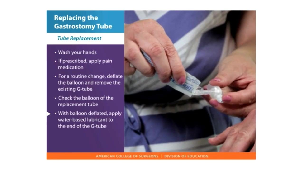 A caregiver applies water-based lubricant to the end of a gastrostomy tube from a packet, preparing it for insertion.