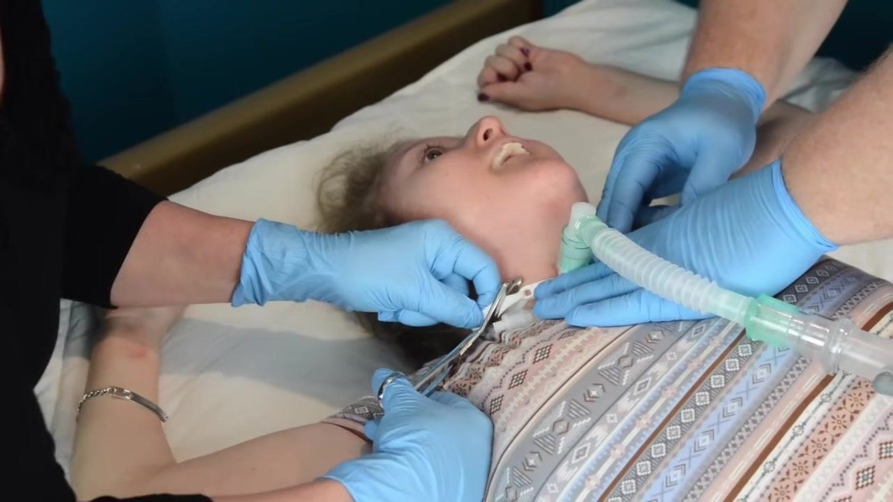 Two caregivers wearing blue gloves: one stabilizes the trach tube at the neck while the other uses scissors to cut the trach tie. The patient lies in bed, connected to a ventilator.