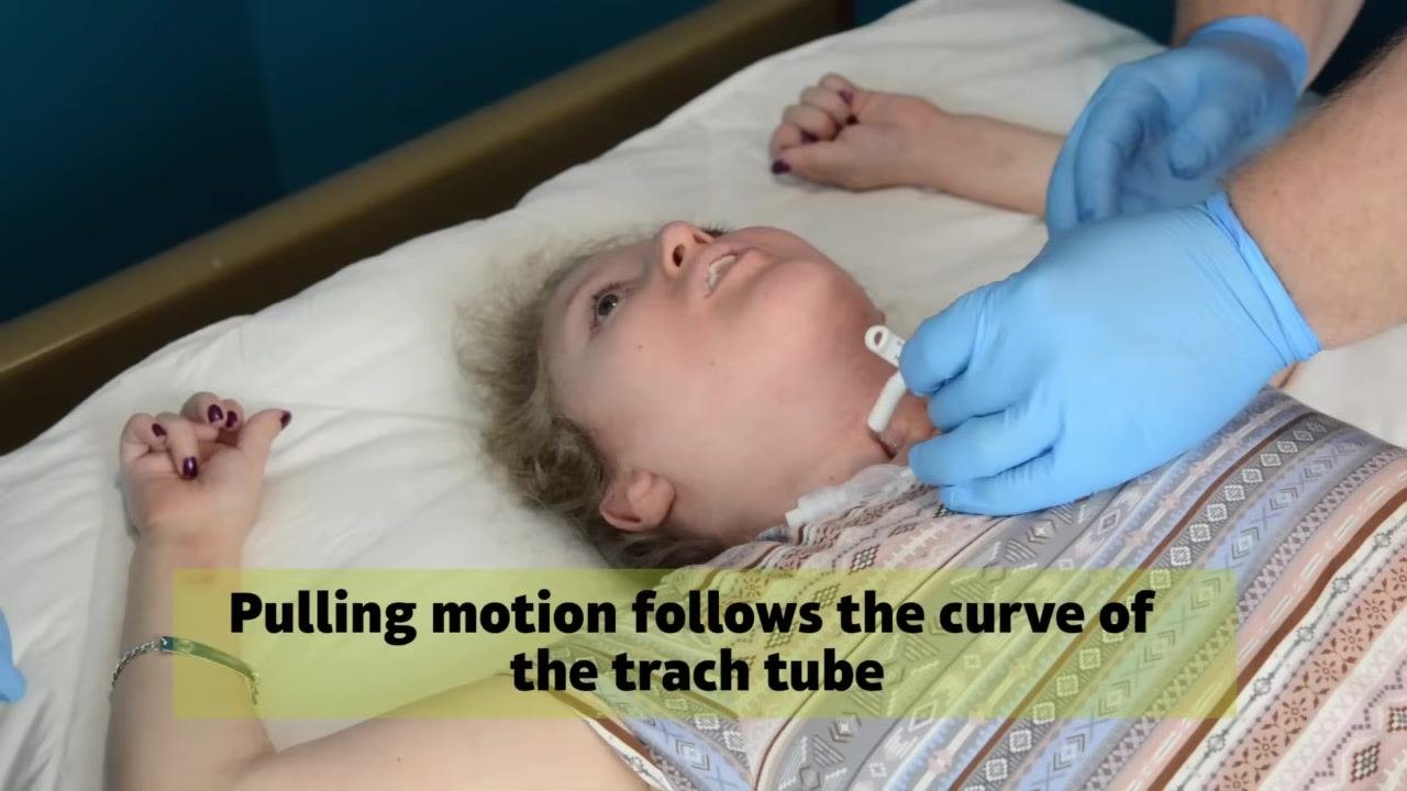A caregiver uses a syringe to deflate the cuff of the trach tube while another caregiver stabilizes the tube. The patient lies in bed with ventilator tubing attached.