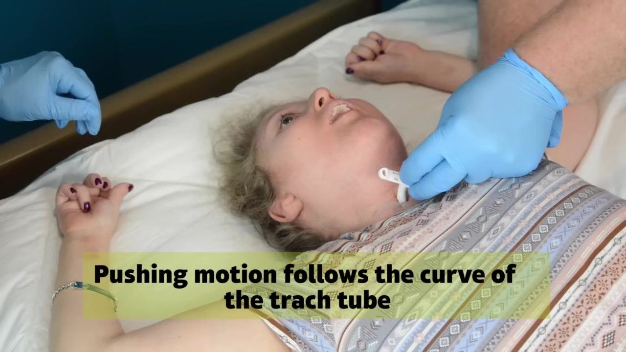 Caregivers disconnect the ventilator tubing from the trach tube while stabilizing the tube at the neck. The patient remains lying in bed.