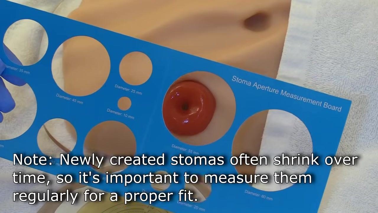 A gloved hand preparing the area around the stoma, indicating where hair may need to be trimmed