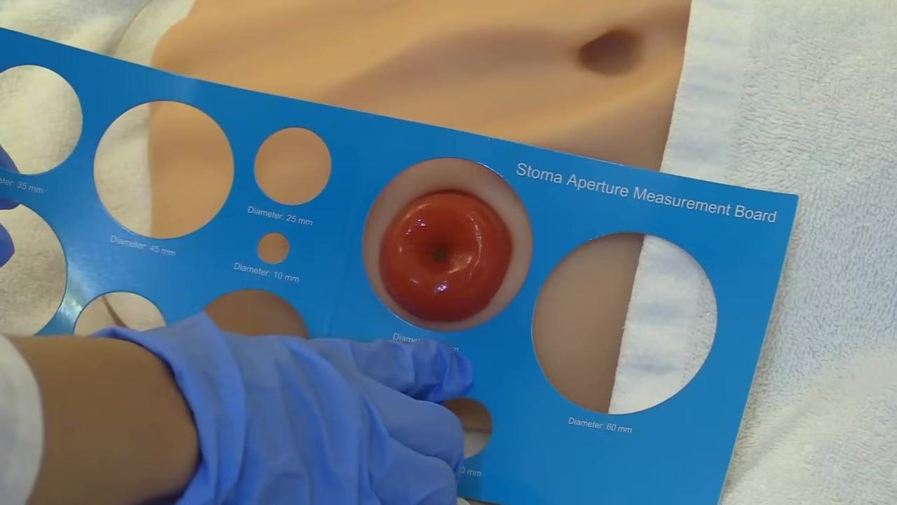 A gloved hand holding the measurement board over a skin barrier wafer, aligning the 45 mm opening; the wafer has concentric circles labeled with diameters