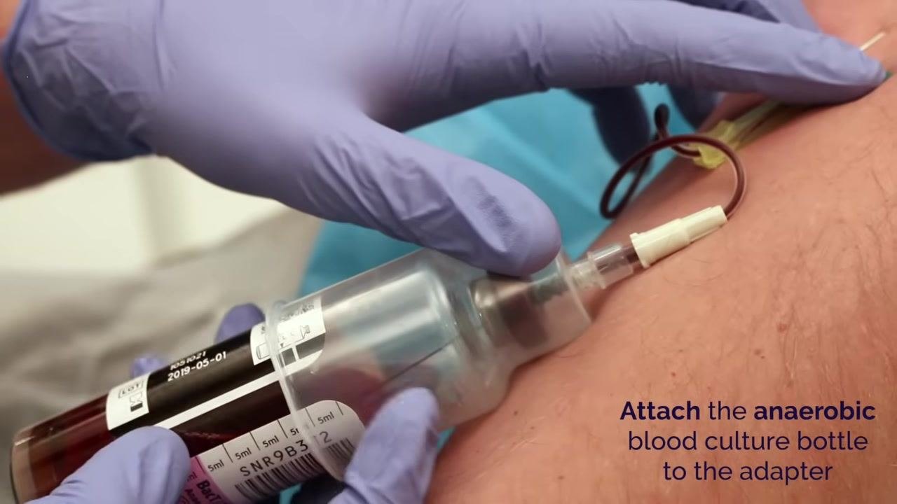 Gloved hands attaching the anaerobic blood culture bottle to the adapter