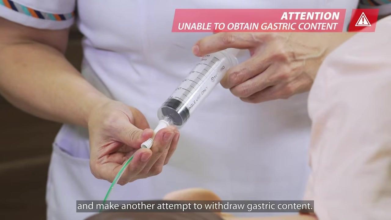 Close-up of a syringe connected to the feeding tube, preparing to inject air