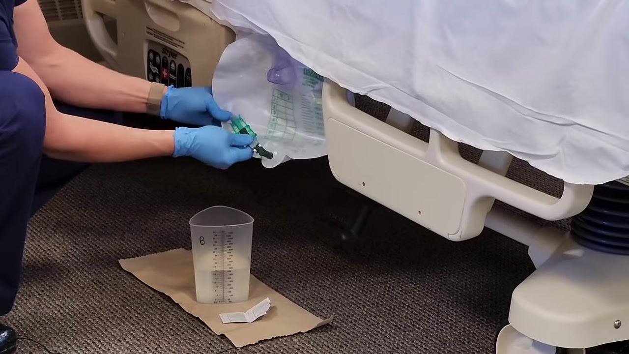 Nursing assistant at the overbed table with the graduated cylinder and hand sanitizer visible, preparing to observe and record urine output