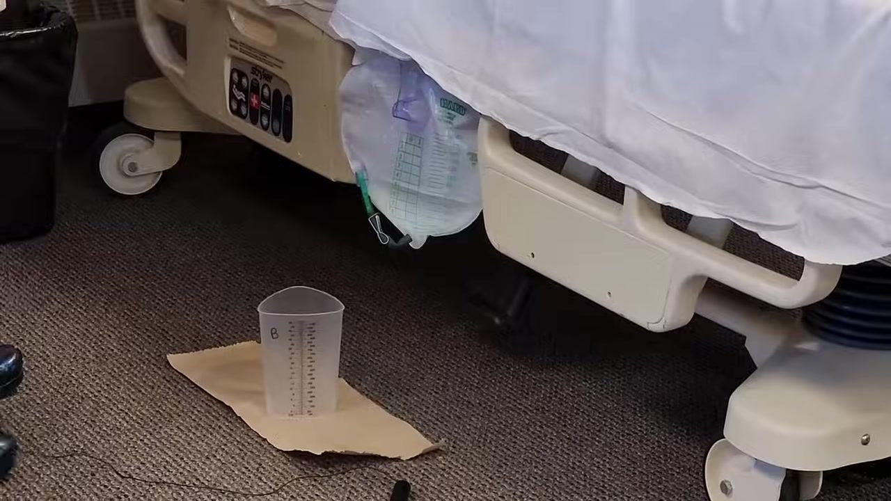 Catheter bag attached to the bed rail with the graduated cylinder placed on a barrier on the floor, ready for collection