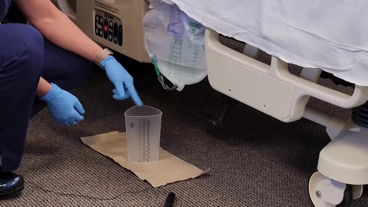 Nursing assistant in gloves pointing to the graduated cylinder on a barrier under the catheter bag, preparing to open the spout