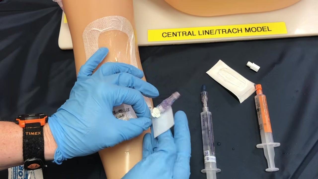 The new cap attached to a saline syringe while saline is gently pushed through to complete priming