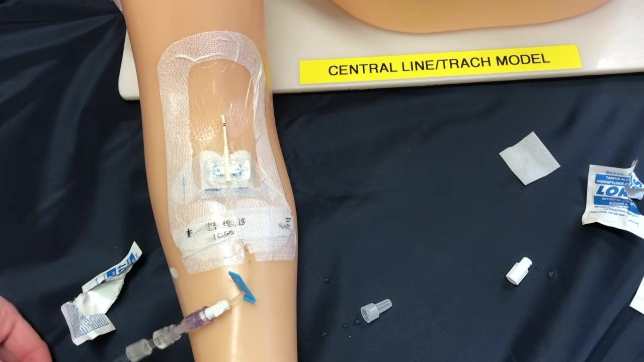 The medication or infusion line attached and unclamped, running smoothly with supplies organized nearby