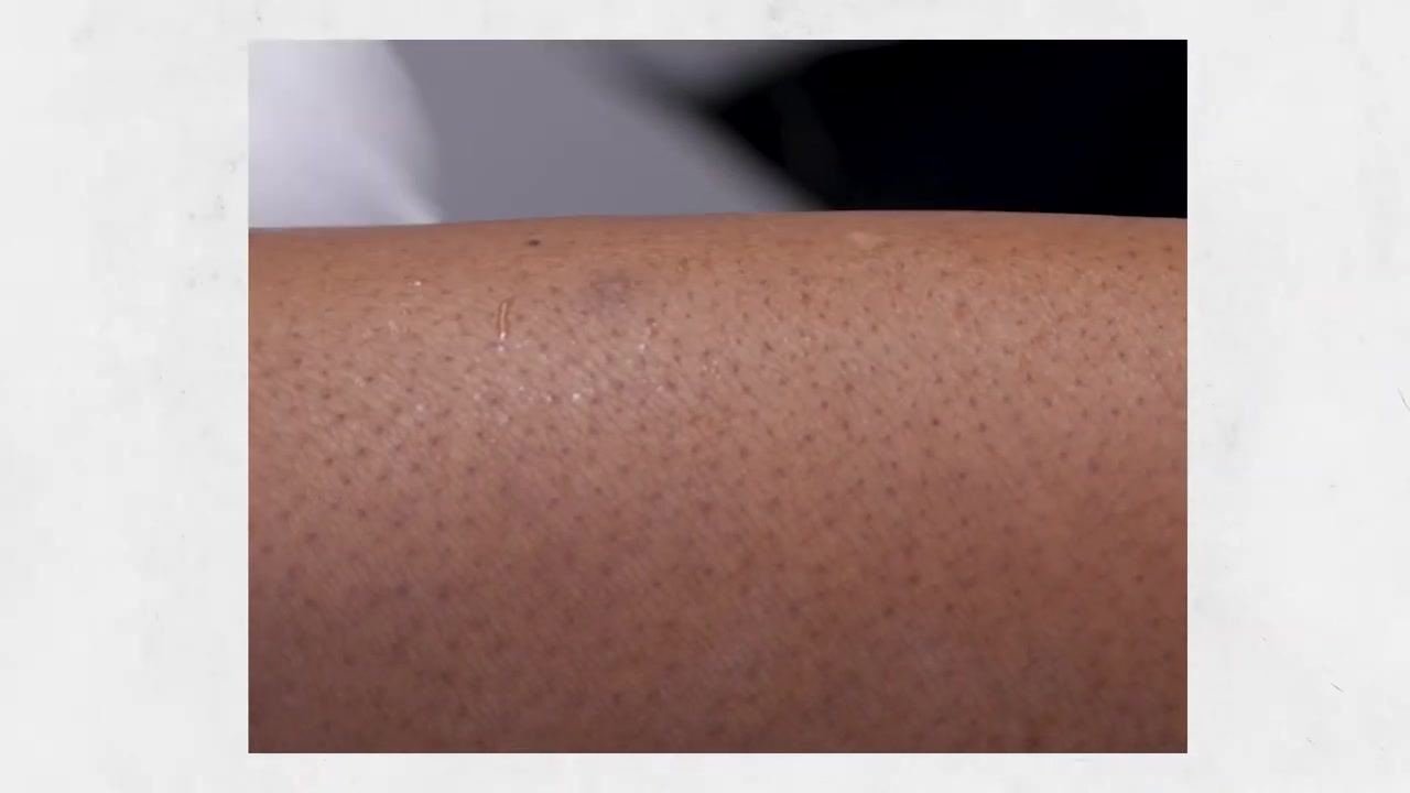Close-up of clean, moisturized skin after proper skin care
