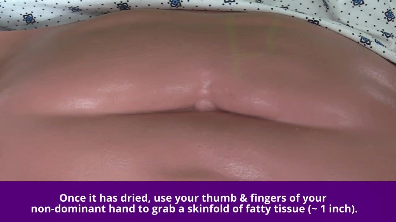 Gloved hand preparing to grasp a skinfold of fatty tissue on the dried, exposed abdomen.