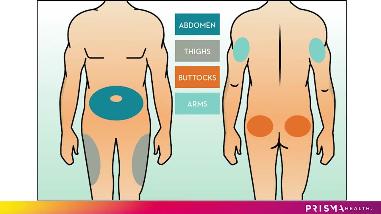 Diagram of a human body (front and back) highlighting injection areas: abdomen, thighs, buttocks, and arms
