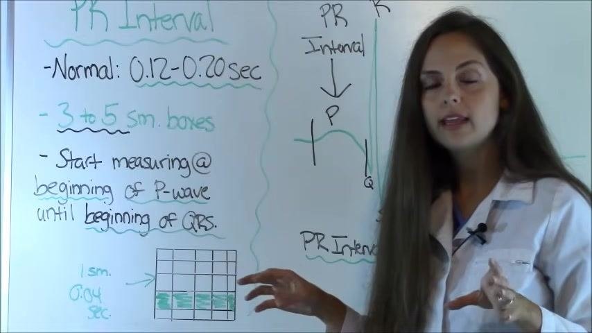 Whiteboard summary showing the normal PR interval range, the 3-to-5 small box equivalent, and instructions to begin measuring at the start of the P wave and end at the start of the QRS complex.