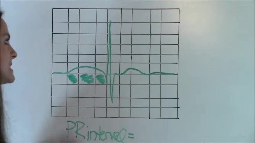 EKG diagram illustrating how to count the small boxes between the P wave and the QRS complex.