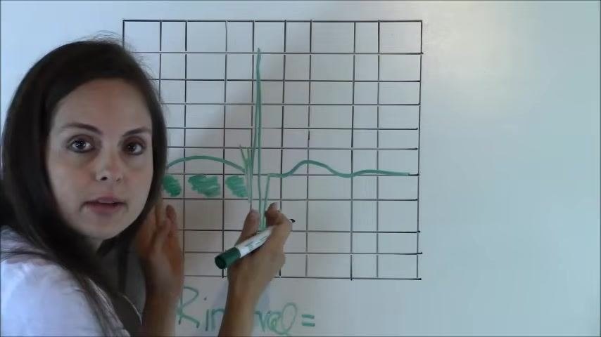 EKG diagram showing three small boxes counted between the start of the P wave and the start of the QRS complex.