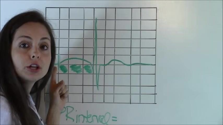 EKG diagram with the PR interval calculation shown alongside the shaded waveform segment.