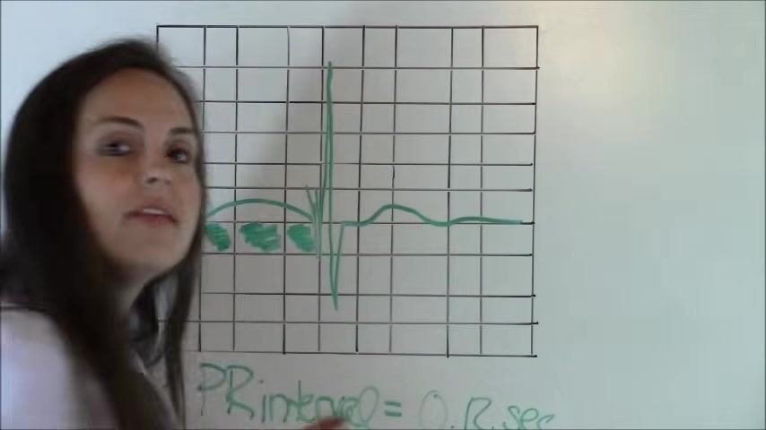 EKG waveform labeled with the calculated PR interval of 0.12 seconds.