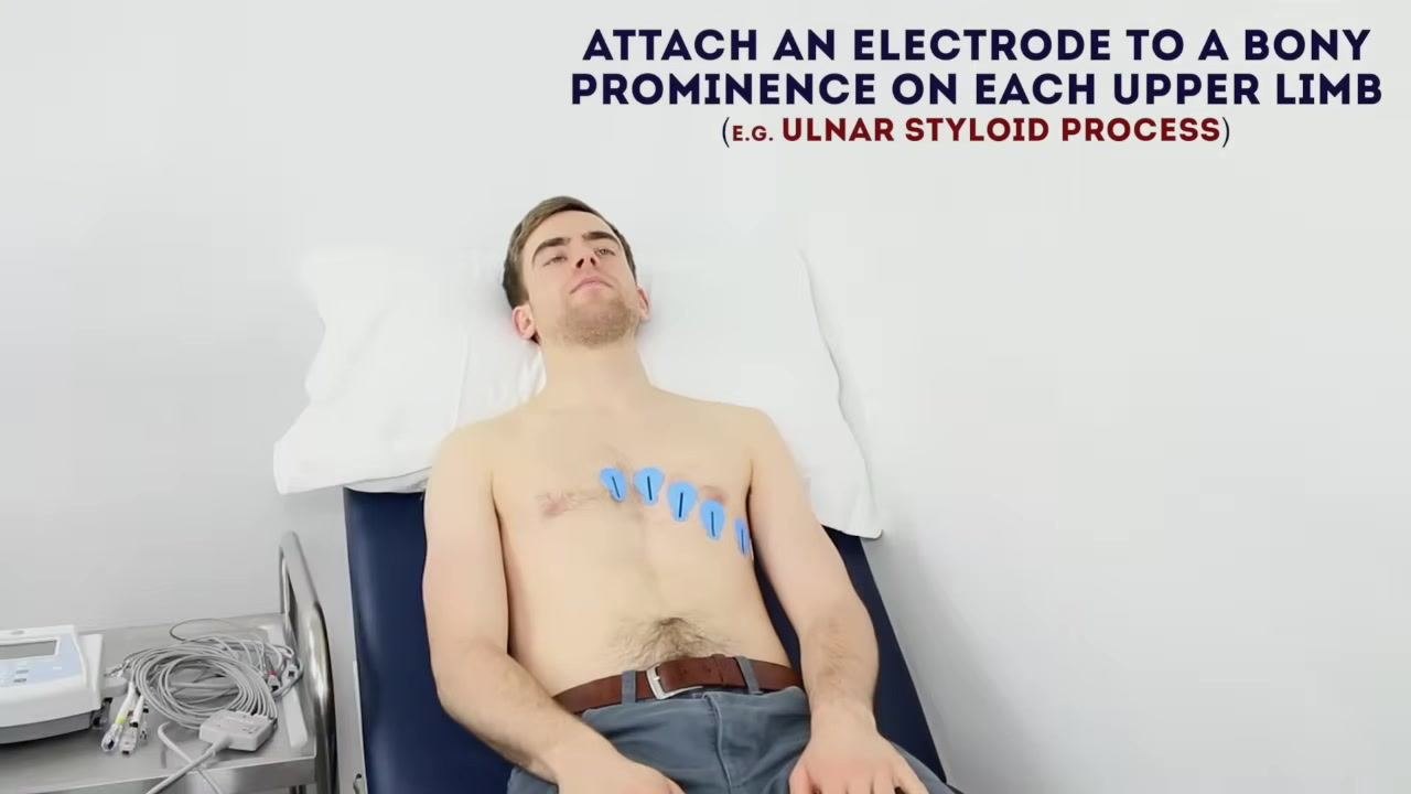 Patient lying on the couch with chest electrodes in place, with the heading "Attach an electrode to a bony prominence on each upper limb (e.g. ulnar styloid process)" above.