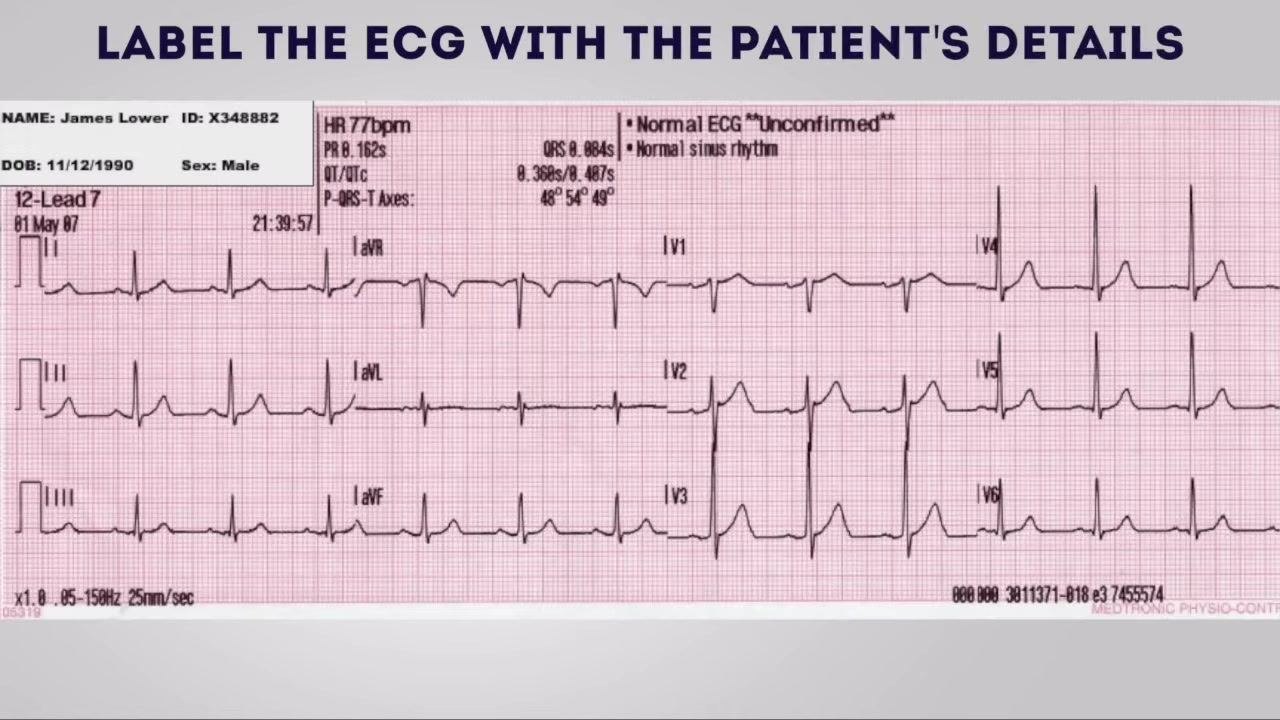 Patient lying still with all leads attached, with the heading "Politely ask the patient to avoid moving or talking during the ECG recording (to reduce electrical artefact)" above.