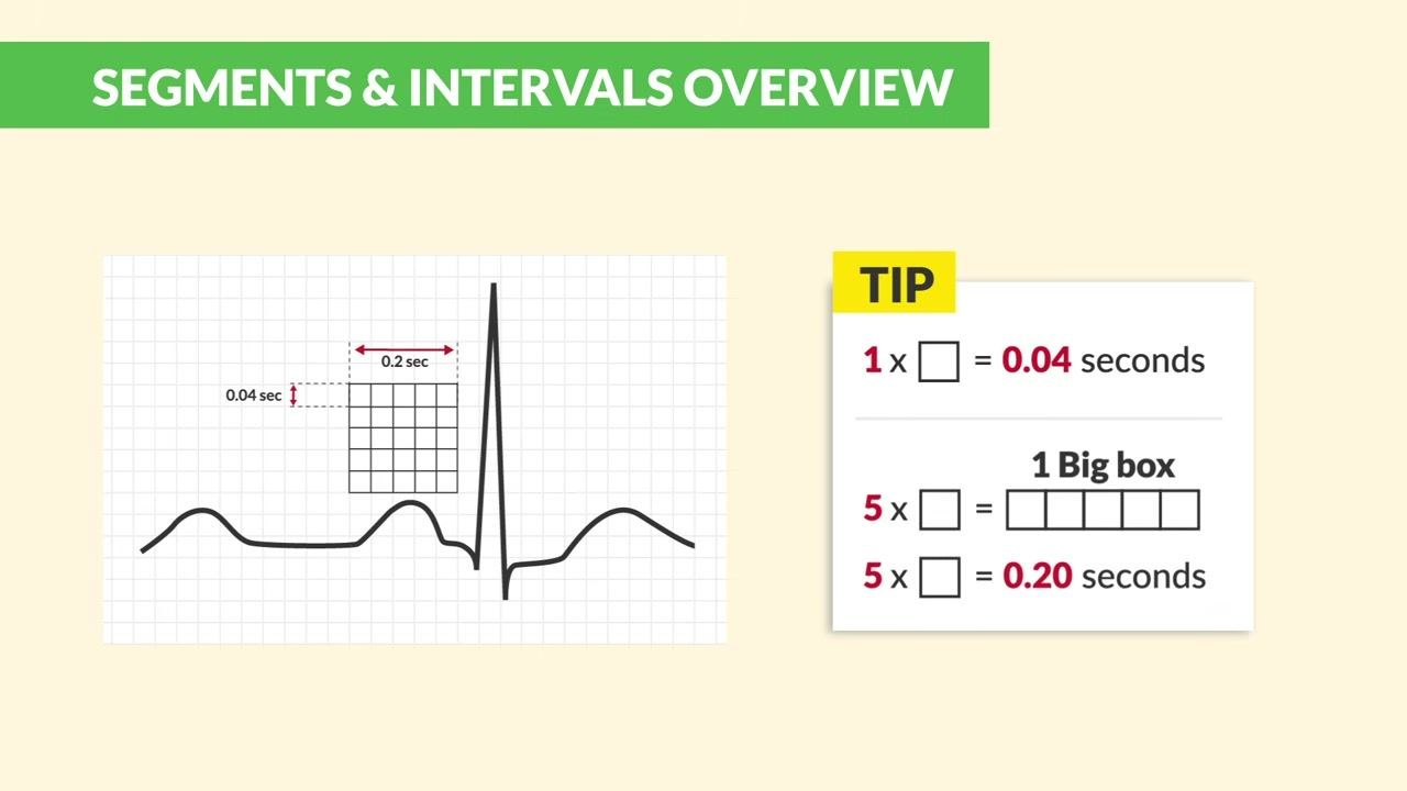 A diagram reads "Widened QRS = Delayed Ventricular Conduction," with a warning icon and the text "> 0.12 seconds."