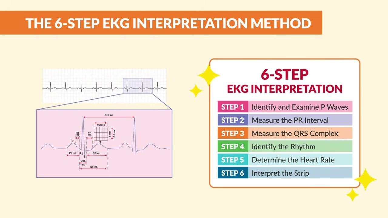 An illustration compares an oversized pair of cargo shorts to EKG strips displaying wide, abnormal QRS complexes with a warning icon.