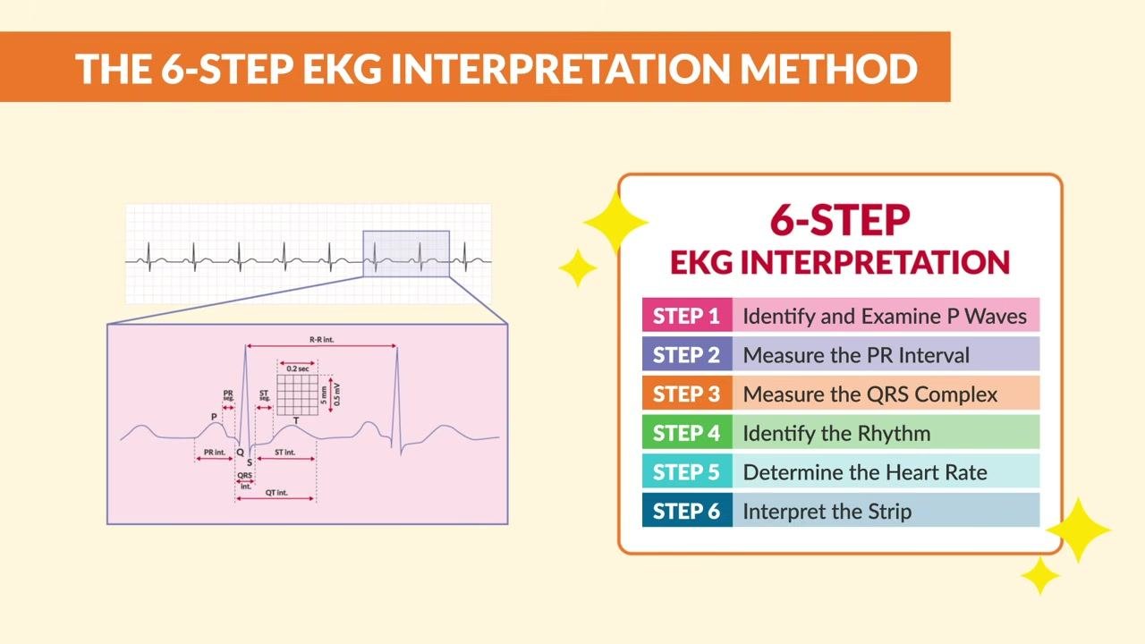 The same EKG strip and waveform appear with the color-coded six-step method visually emphasized.