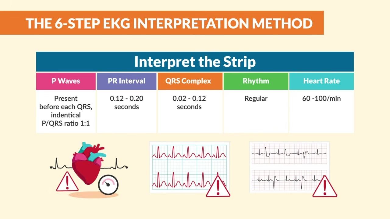 A heart illustration, an irregular EKG strip, a warning icon, and a "Heart Block" label appear alongside the six-step method with Step 4 highlighted.